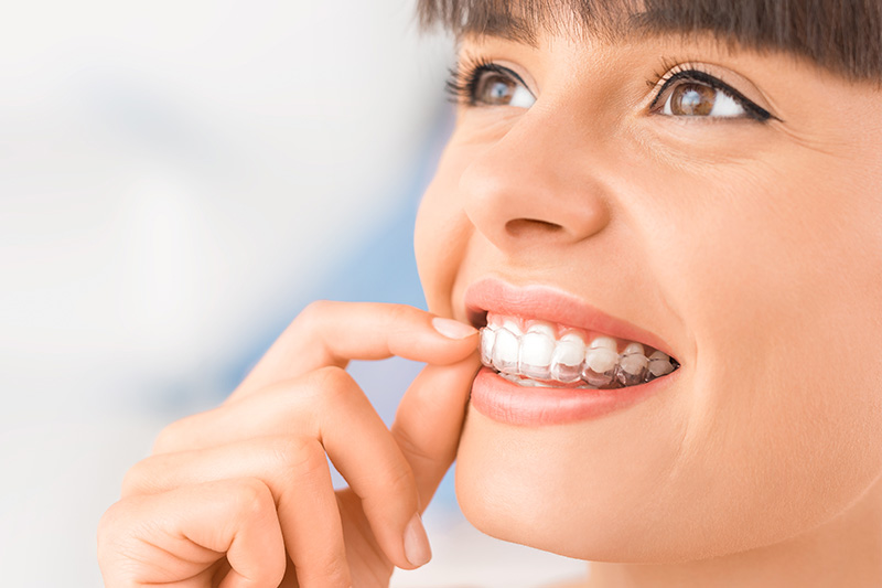 Invisalign in Robbinsdale